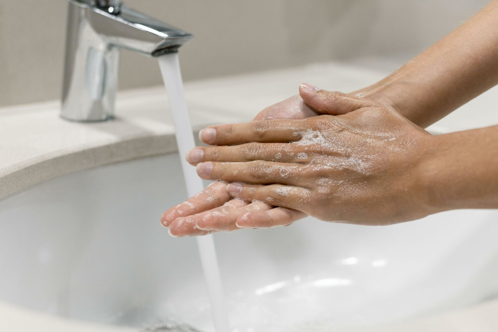 Rửa tay thường xuyên và đúng cách để ngăn ngừa lây lan bệnh giời leo. Nguồn: Internet