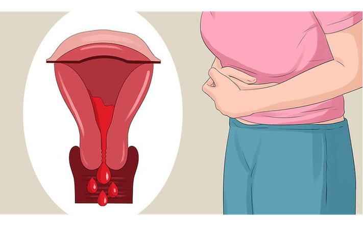 Nguyên nhân chị em phụ nữ thường đau bụng khi đến tháng